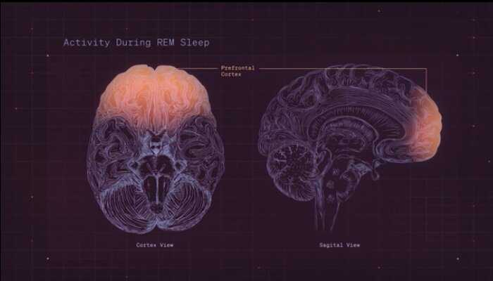 Brain activity during REM sleep